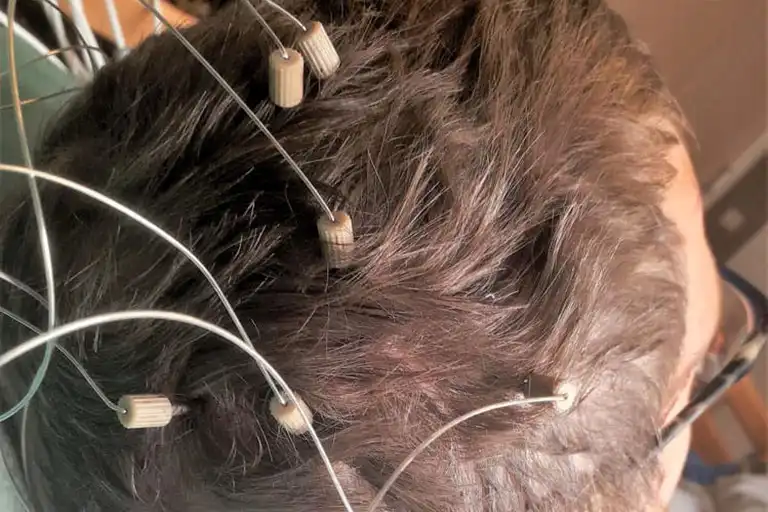 Diepteregistratie ervaring