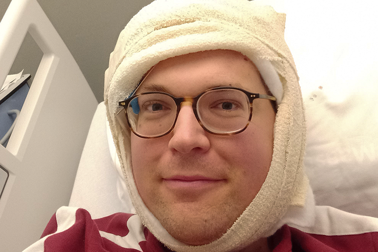 epilepsiechirurgie ervaring